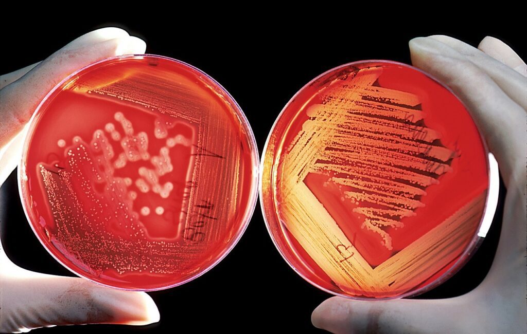 blood agar for antibiogram
